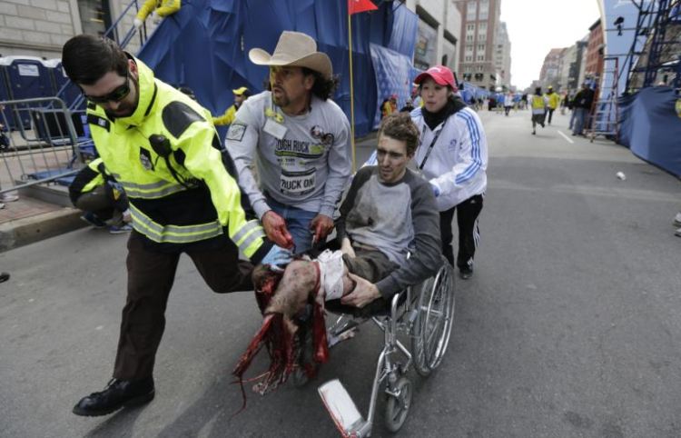 http://www.abbaswatchman.com/Boston%20bombing%20fake%20leg%20gets%20put%20on%20by%20amputee%20actor%20in%20pictures%20that%20can%20not%20be%20disputed%20April%2024%202013%20(5).jpg